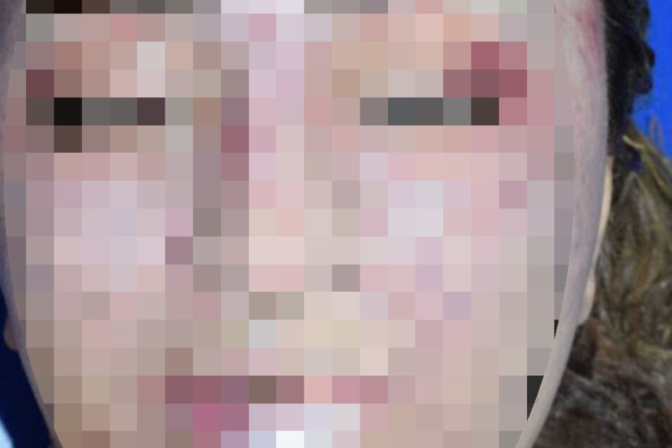Im Gesicht der Frau sind Verletzungen zu erkennen.