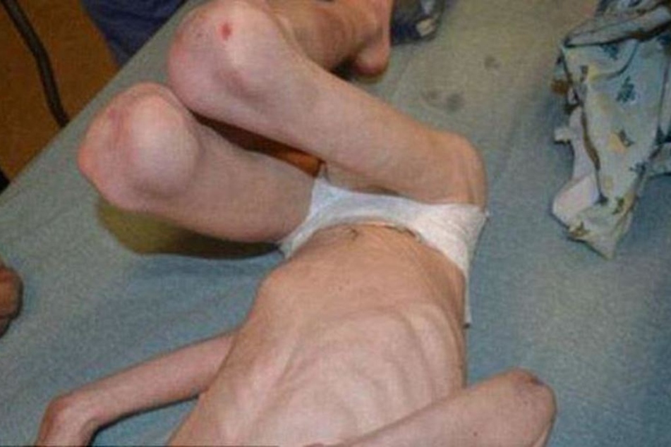 Der damals Fünfjährige wog zum Zeitpunkt seines Funds nur knapp 13 Kilo.