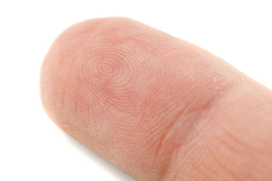 Ob die Fingerkuppe wieder angenäht werden konnte, blieb unklar. (Symbolbild.)
