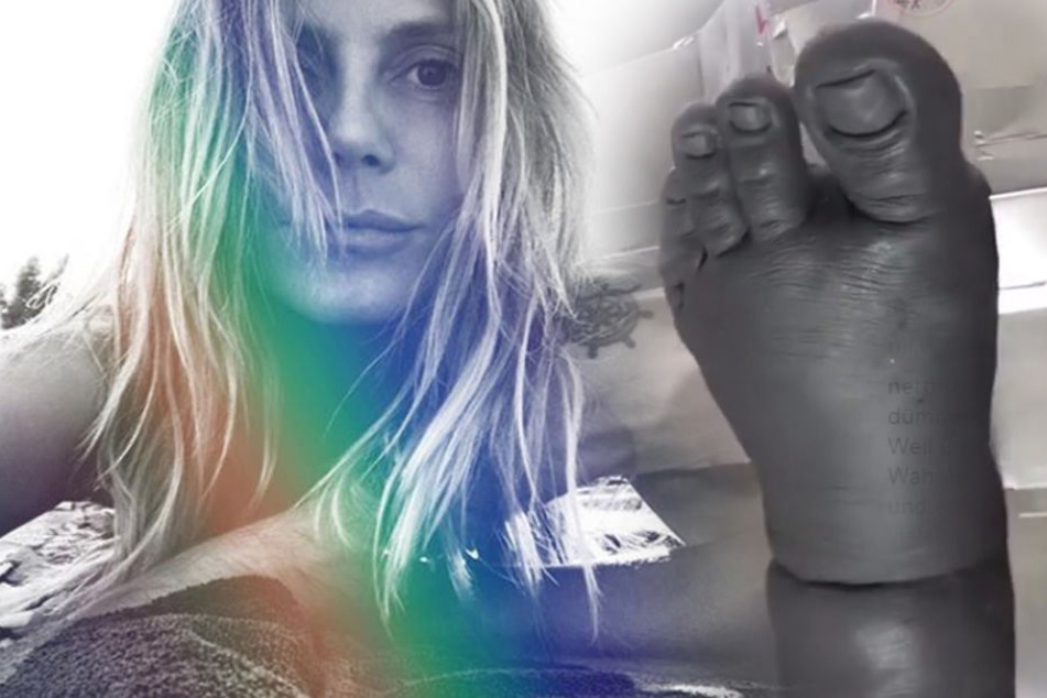 Heidi Klum präsentiert auf Instagram diesen dicken Klumpfuß.