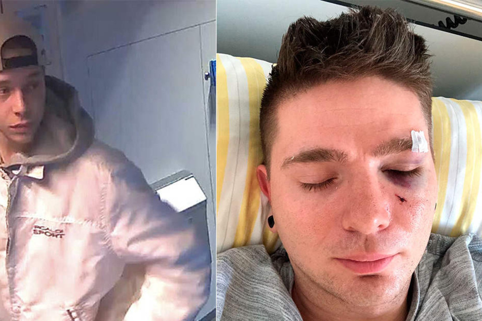 Noch immer sucht die Polizei den brutalen Schläger (li.). Nach der Attacke am vierten November, landete Tom im Krankenhaus.