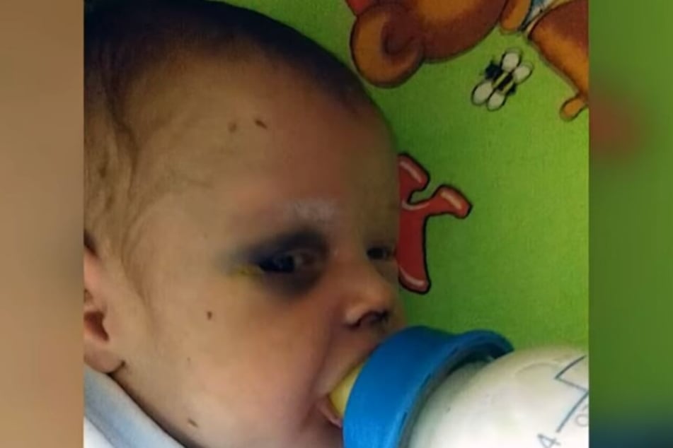 Schwer verletzt fanden Nachbarn das Baby in der Wohnung seiner Mutter.