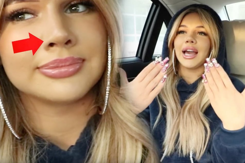 Zuletzt ließ sich die YouTuberin ihre Nase richten.