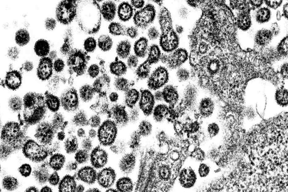 So sieht das tückische Lassa-Virus unter dem Mikroskop aus.