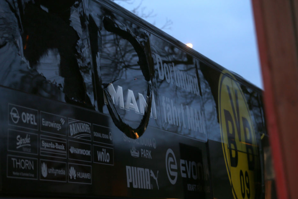 Bei der Explosion am Bus wurde Marc Bartra schwer am Arm verletzt und musste operiert werden.