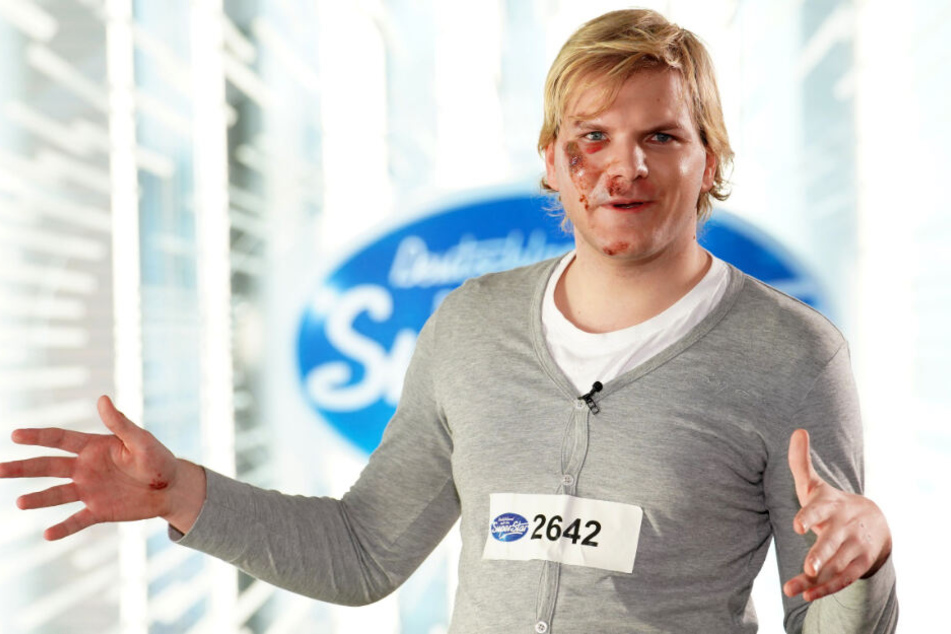 Das Gesicht des 26-Jährigen ist mit Wunden übersät.