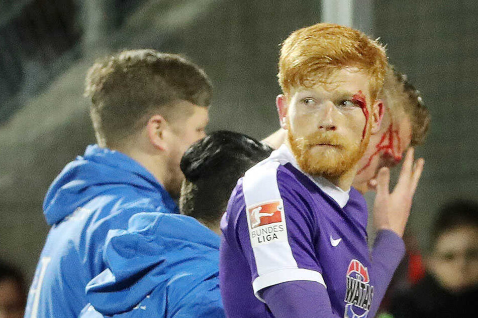 Auch klaffende Wunden können ihn nicht stoppen: Fabian Kalig im März beim Sieg über den KSC.