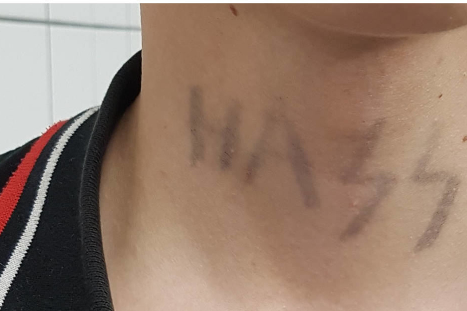 Mit einem Filzstift hatten sich die 18-Jährigen unter anderem das Wort "Hass" mit den verbotenen SS-Runen auf den Körper gemalt.
