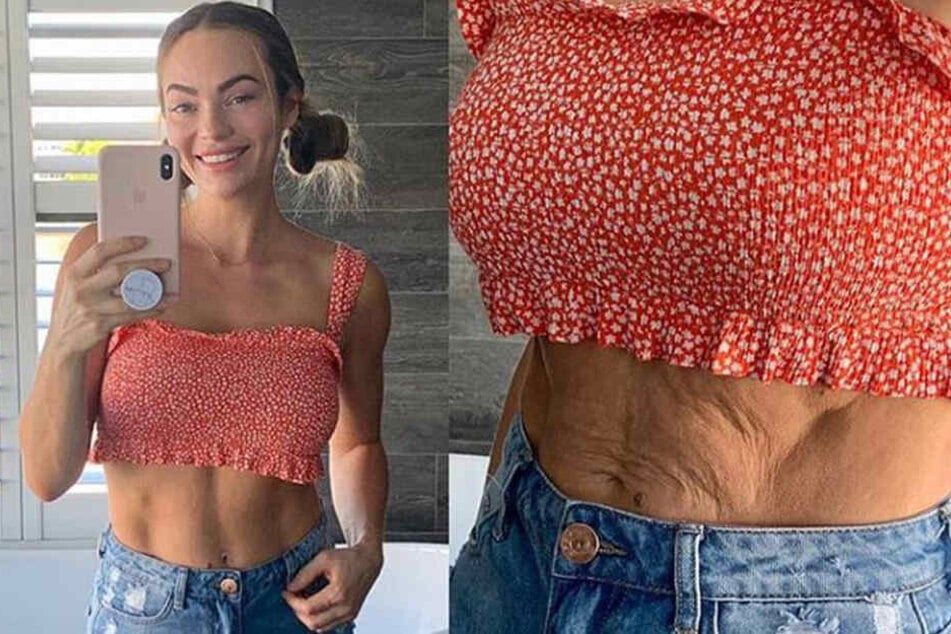 Auf Instagram zeigt die Influencer-Mama auch die unschönen Seiten der Schwangerschaft.