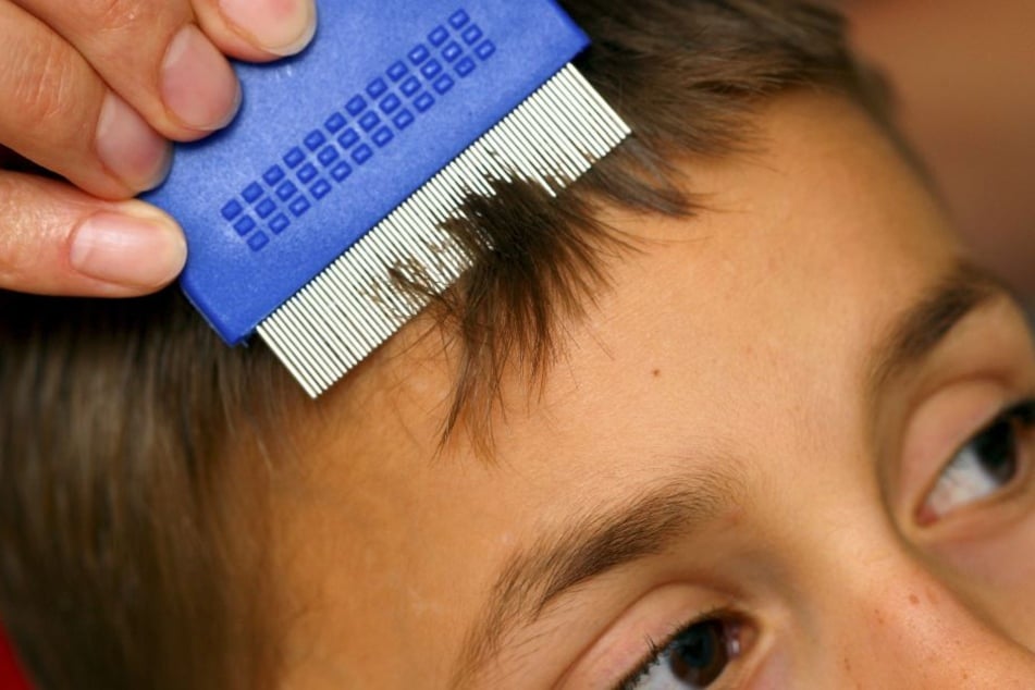 Mühsam: Die Haare mit einem Läusekamm absuchen.