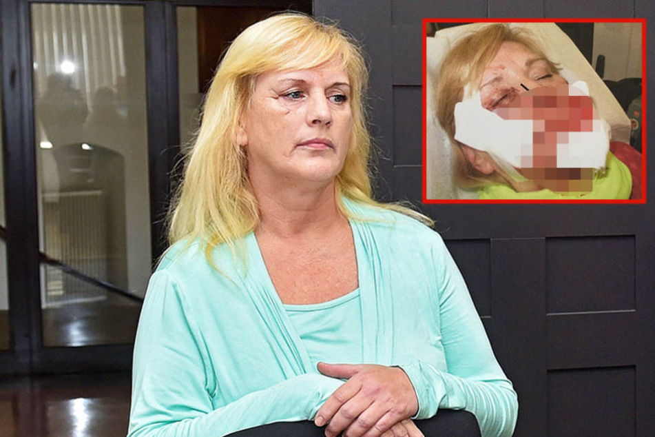 Marion Z. (56) musste für ihre Ehe mit Kamel K. (54) teuer bezahlen, trägt noch heute Narben.
