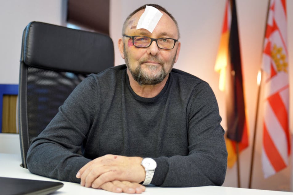 AfD-Politiker ist von dem Angriff sichtlich gezeichnet.