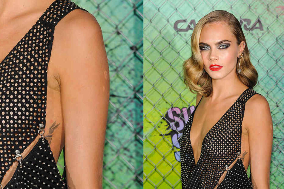 Model Cara Delevingne (24) hat mit Schuppenflechte zu kämpfen.