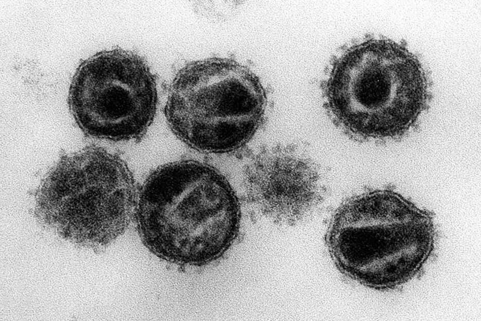 Elektronenmikroskopische Aufnahme mehrerer HIV (Humane Immunschwäche-Viren) Erreger der Immunschwäche-Krankheit Aids.