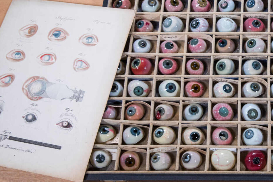 In einem Setzkasten liegt ein Teil der insgesamt 132 Pathologien des historischen Glasaugenarchivs der Augenklinik des Rostocker Universitätsklinikums neben einer Zeichnung mit verschiedenen Augenkrankheiten.