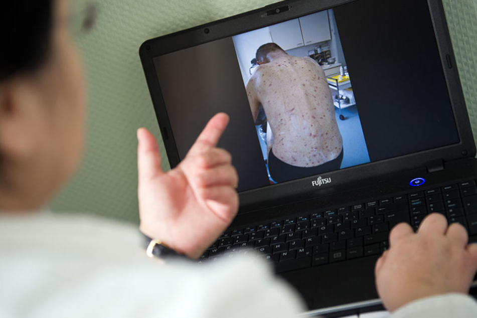 Eine Berliner Ärztin zeigt einen von Krätze betroffenen Patienten. (Archivbild)