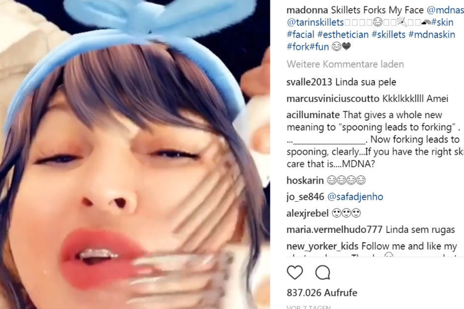 Gabeln sollen Madonna neue Schönheit geben!