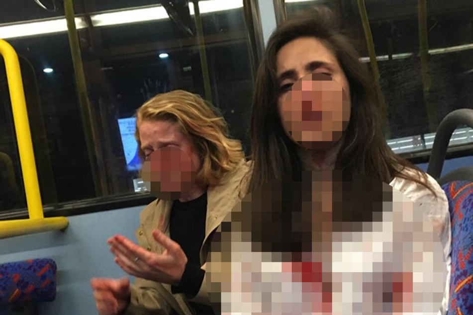 Die beiden Frauen bluteten nach der Attacke heftig.