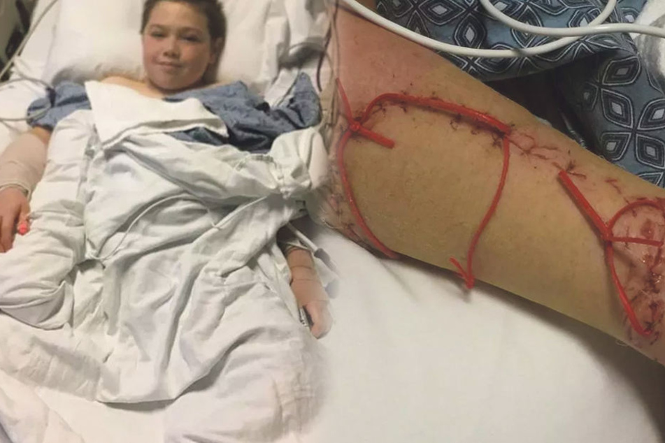 Jei im Krankenhaus. Der Hai hatte ihn schwer am Arm verletzt.