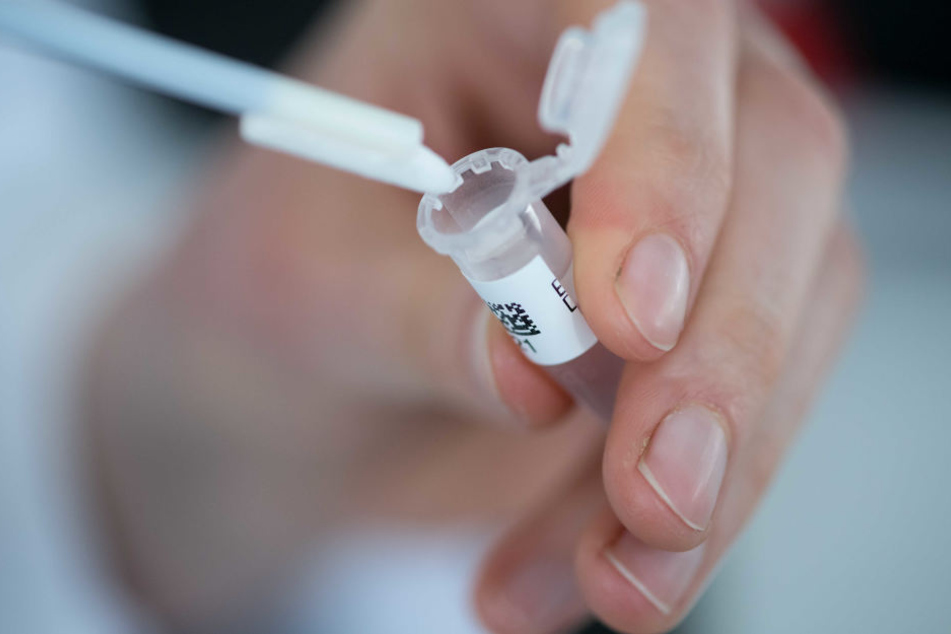Ein DNA-Test soll nun Aufschluss geben.