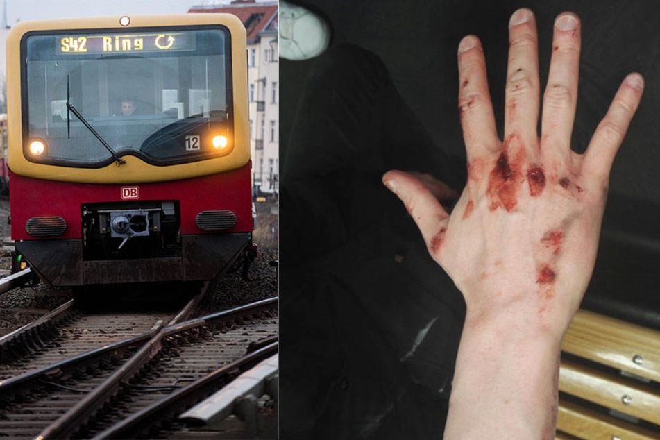 Glück im Unglück: Der junge Mann kam mit leichten Verletzungen an der Hand davon.