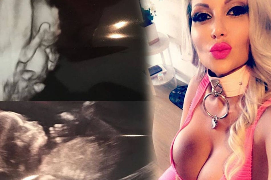 Sophia Vegas will die Zweifel der Fans aus dem Weg räumen: Vor kurzem postete sie ein Ultraschallbild.