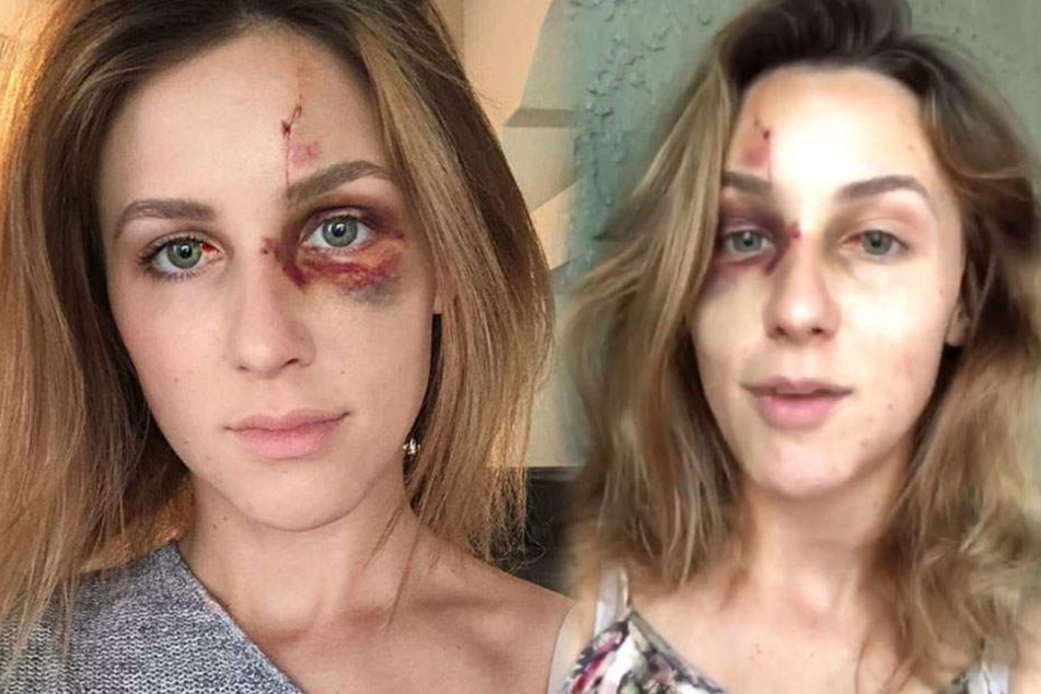 Melissa Gentz berichtet auf Instagram über die Attacke ihres damaligen Partners.