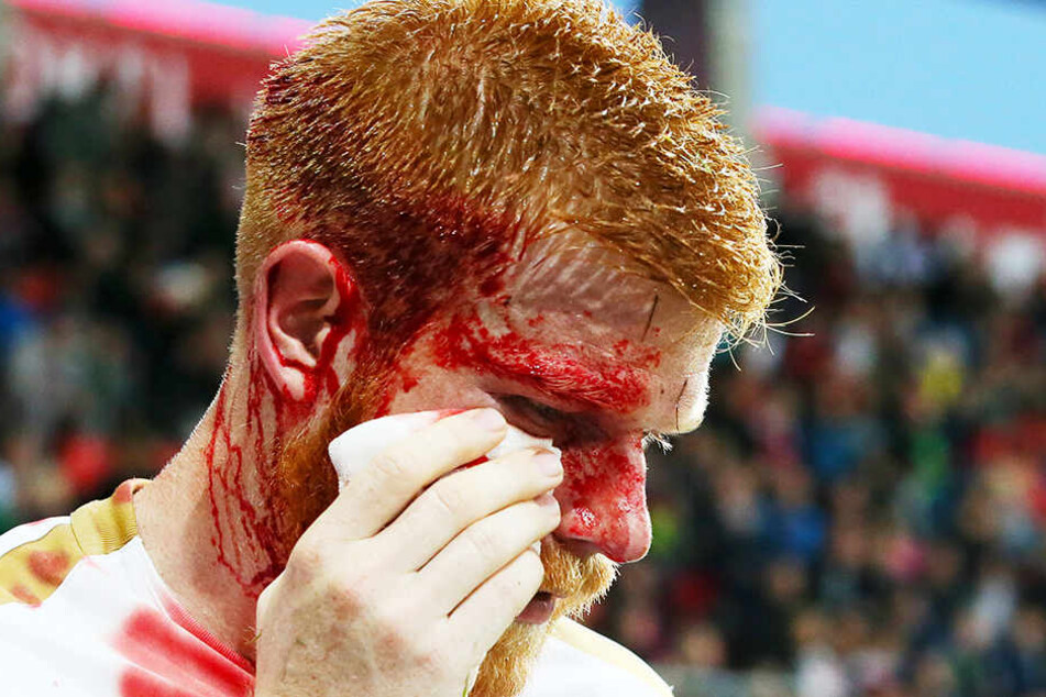 Fabian Kalig mit seinem blutverschmierten Gesicht beim Spiel in Ingolstadt. Der Cut wurde mit mehreren Stichen genäht.