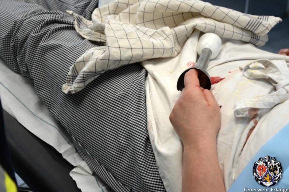 Erst die Feuerwehr aus Erlangen konnte den Finger aus dem Stabmixer befreien.