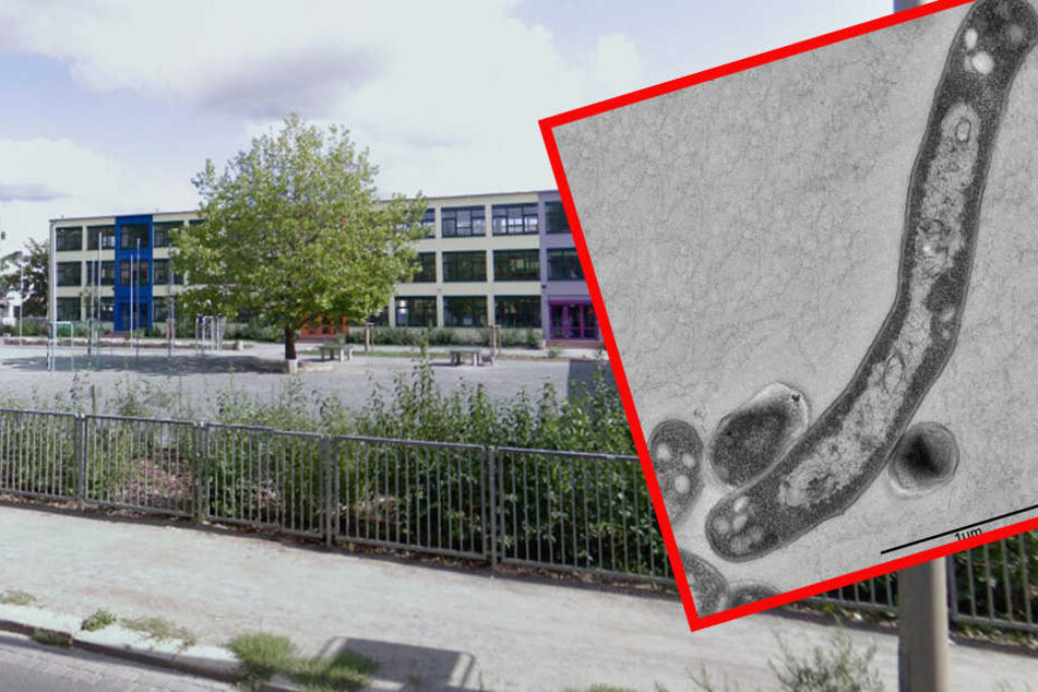 Am Dresdner Hoga-Gymnasium ist Tuberkulose ausgebrochen.