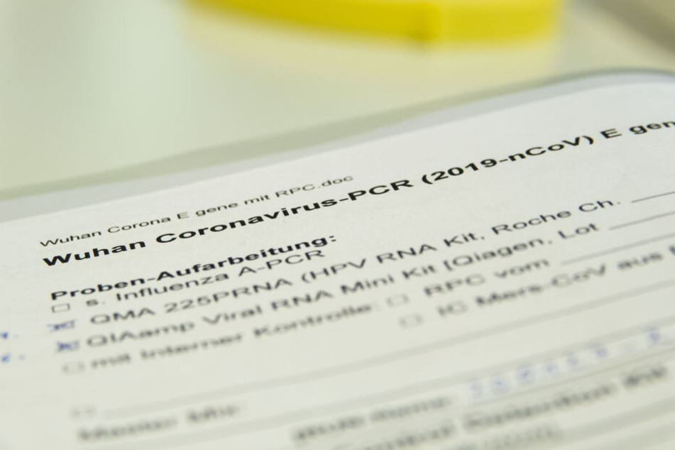 Eine Akte mit der Aufschrift "Wuhan Coronavirus" liegt in einem Labor des Landesgesundheitsamtes Niedersachsen (NLGA).