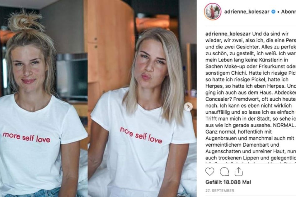 Adrienne zeigt sich gern ungeschminkt und redet offen und ehrlich über ihre Hautprobleme. Ihre Follower lieben ihre authentische Art.