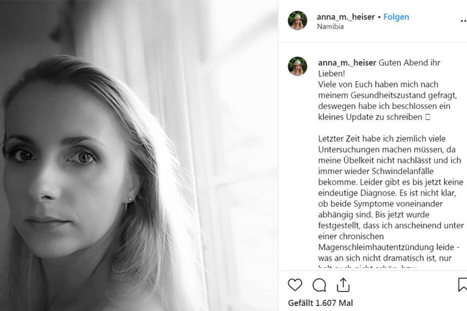 Anna (28) hat keine guten Nachrichten für ihre Fans.