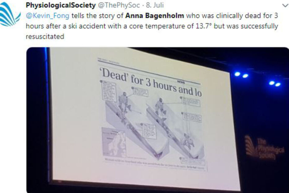 Anna Bagenholm war drei Stunden klinisch tot und überlebte.