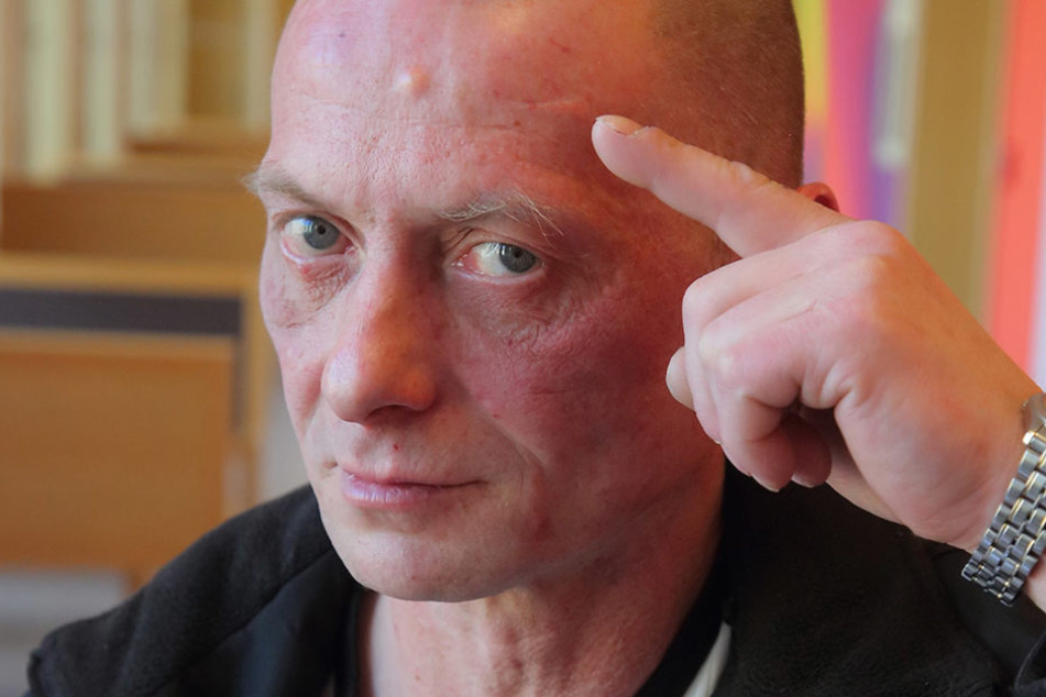Rene K. (45) zeigt die Narbe an der Stirn, die ihm der Nachbar beibrachte.