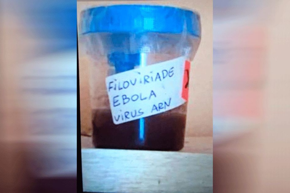 Enthält dieser Behälter Blut, das mit Ebola infiziert ist?