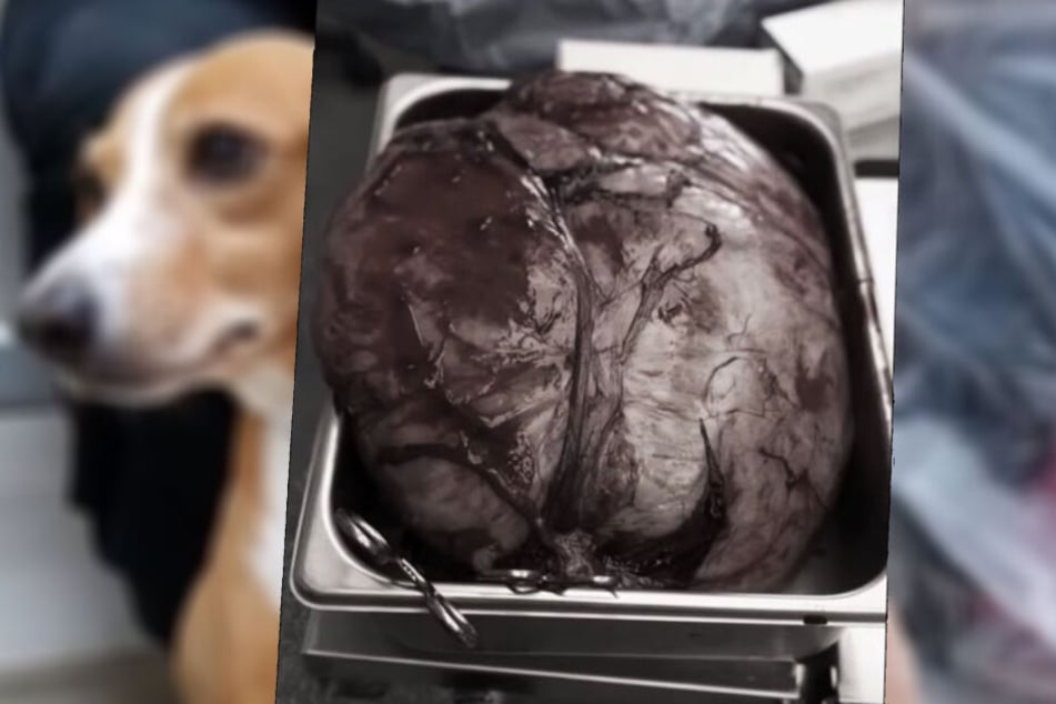 So groß war der Tumor.
