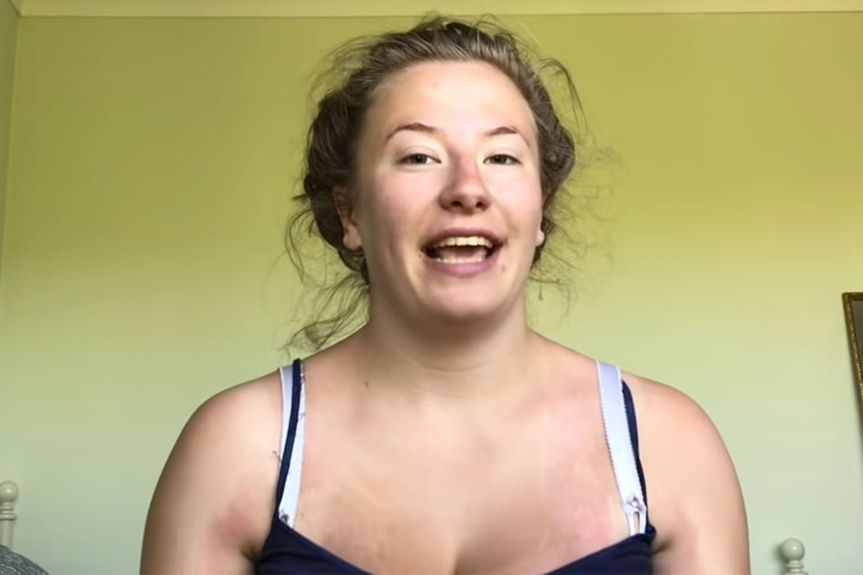 Auf ihrem YouTube-Kanal erklärt Hermione Cox-Denning, wie sie mit der Krankheit lebt.