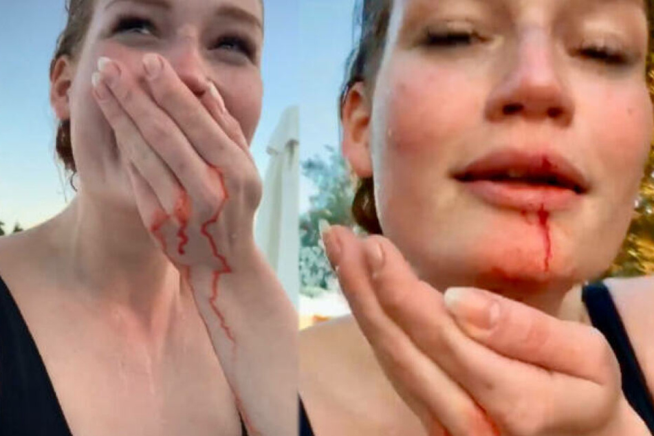 So verletzt zeigte sich Jana Heinisch ihren Fans bereits in einer früheren Instagram-Story.