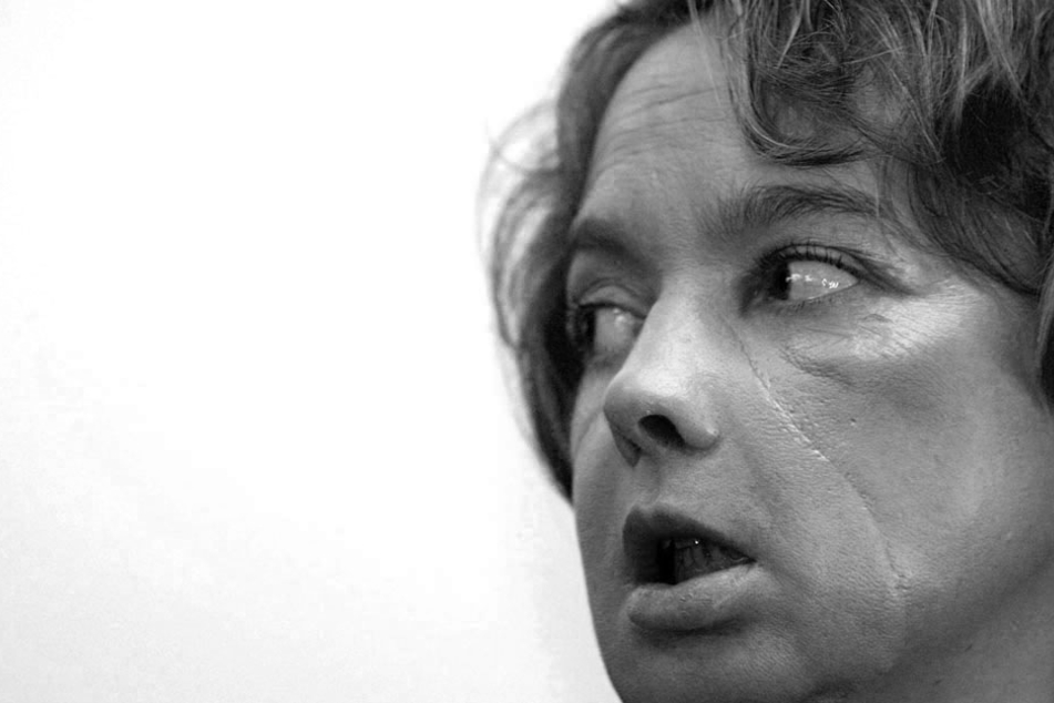 Isabelle Dinoirs Hund hatte sie aufgrund eines Ohnmachts-Anfall so stark gebissen, dass ihr Gesicht entstellt wurde.