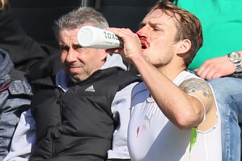 Schon wieder gebrochen? Wachsmuths Nase war nach einem Zusammenprall mit dem eigenen Keeper und Großaspachs Julian Leist blutig.