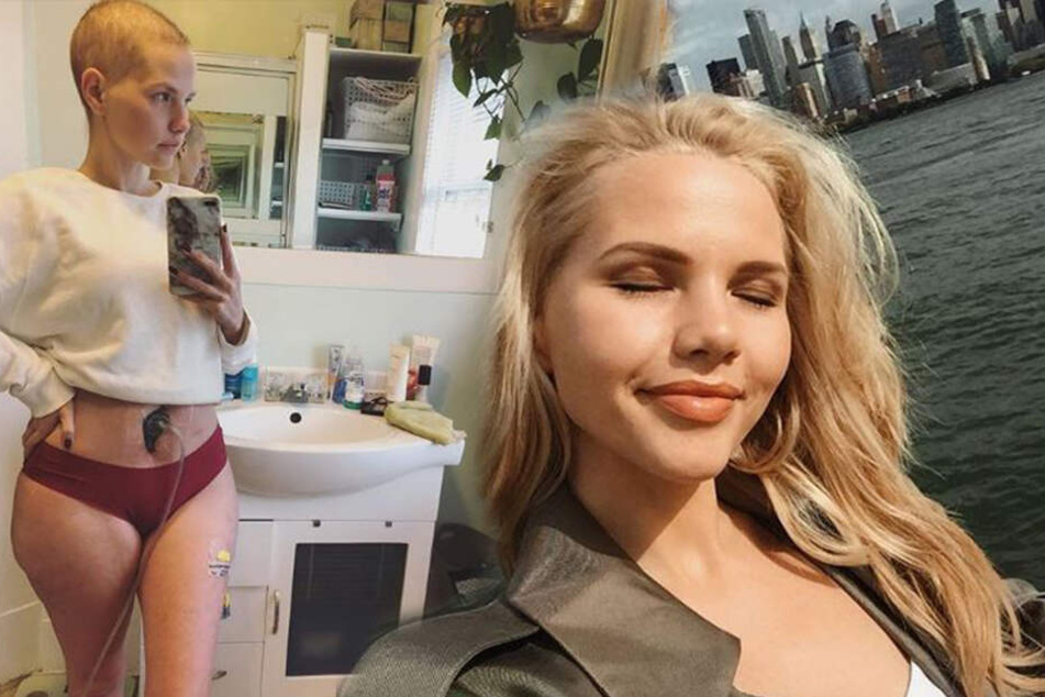 Neben Selfies postete die 30-Jährige auch Aufnahmen ihrer Chemotherapie.