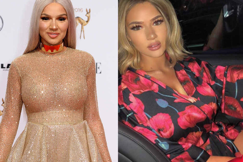 Hat sich Shirin David operieren lassen?