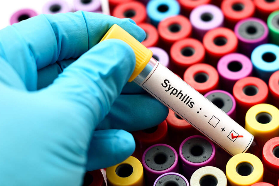Manche Infektionen schleichen sich schmerzlos an, so wie die Syphilis, bei anderen juckt und brennt es "untenrum".