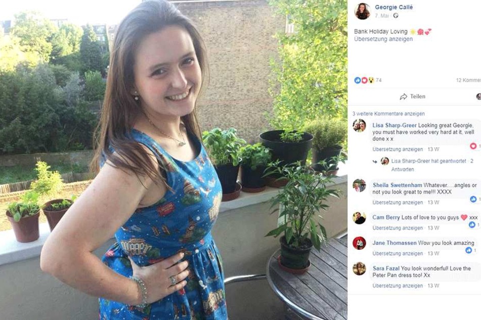 Georgie Callé (25) sieht mittlerweile völlig anders aus.