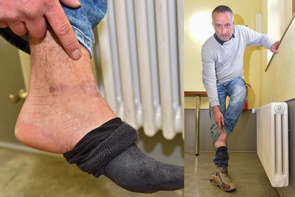 Rico L. (43) zeigt, wo das Geschoss den Fuß (Kreis) traf. Der Landwirt wurde vom Trecker geschossen.