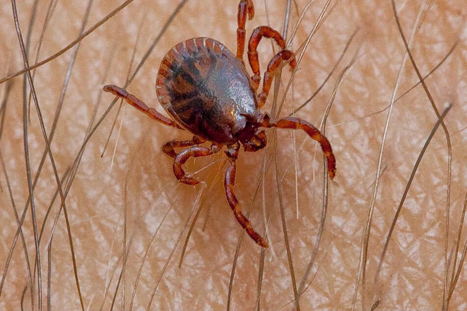 Kleiner Biss, große Probleme: Von Zecken übertragene Borrelien können zehn Jahre lang unerkannt im Körper überleben, bevor die Krankheit ausbricht.