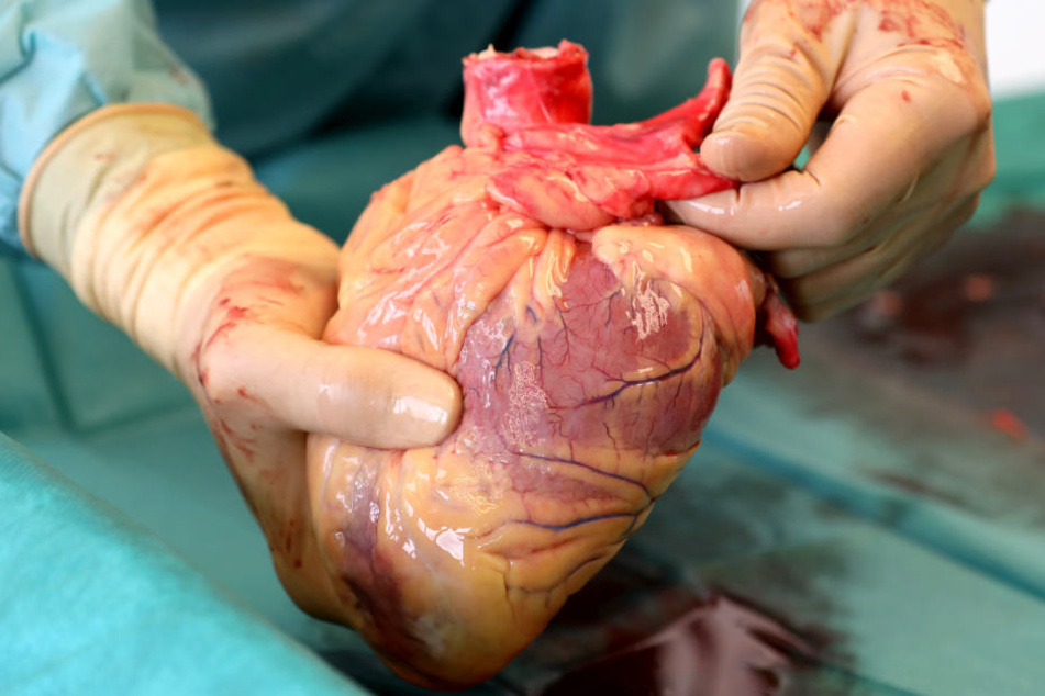 Ein Transplantationsmediziner hält das Herz eines Verstorbenen in den Händen, das kurz zuvor entnommen wurde.