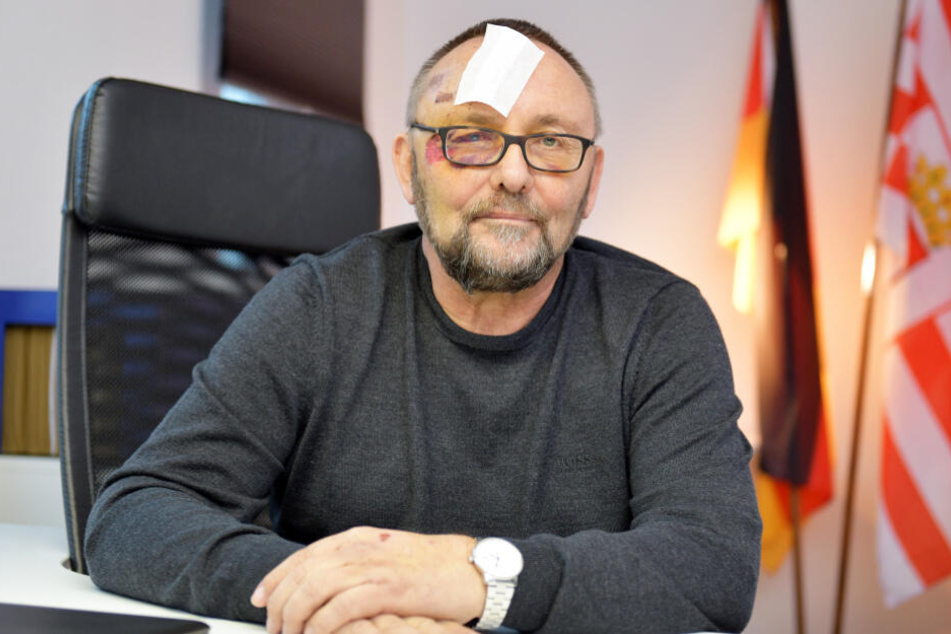 Die Verletzungen sind noch deutlich im Gesicht von Frank Magnitz zu erkennen.