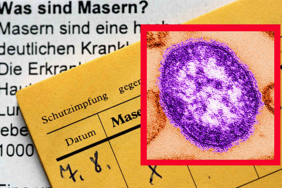 Der Masernvirus (roter Kasten) löst eine der ansteckendsten Erkrankungen aus.